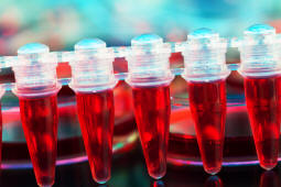 http://pharmaguide.co/wp-content/uploads/2014/08/hematology-CMP-analysis-nursing-monitoring.jpg